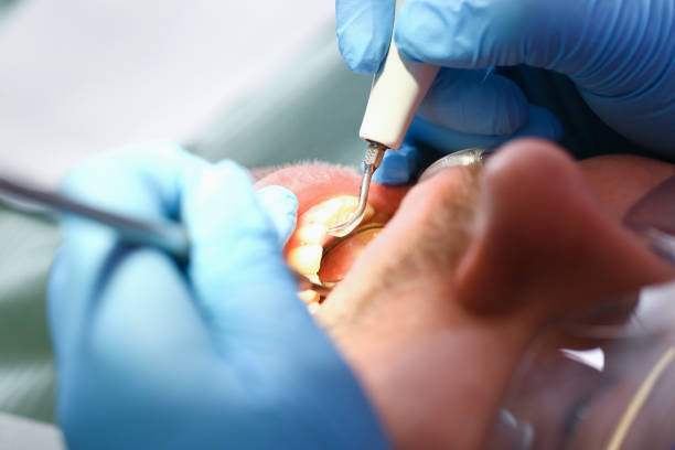 Best Pediatric Emergency Dentist in Seminole, FL